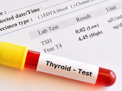 thyroid lab test.