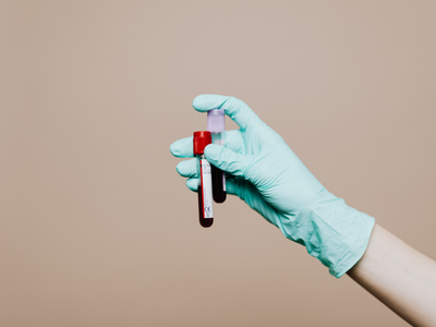 thyroid lab test.
